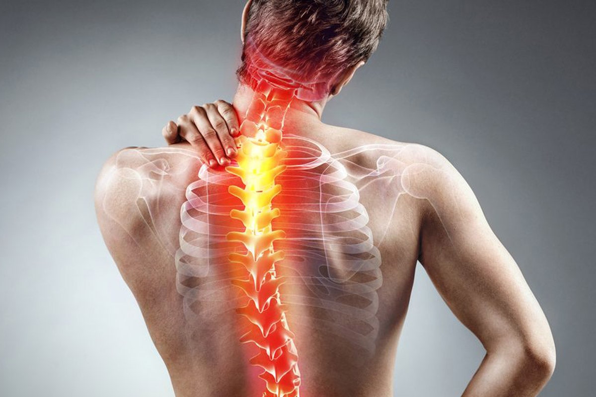 Cervical Pain